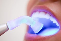 Close up of an open mouth getting an oral cancer screening with the blue light
