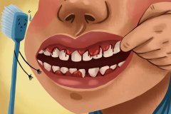 Cartoon image of a mouth full of bleeding gums and a crying toothbrush