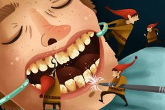 Cartoon of little elves providing a deep cleaning on the patient's teeth.